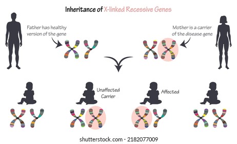 Vererbung von mit X verbundenen rezessiven Genen in Infografik
