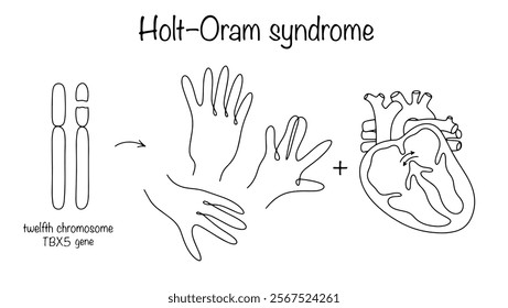 An inherited genetic disorder that affects the development of the upper limbs and heart. Caused by a defect in the TBX5 gene. Holt–Oram syndrome. Simple medical illustration.