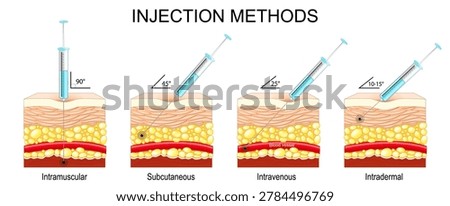 Injection methods. Intravenous, Intradermal, Subcutaneous, Intramuscular. Cross section of human skin. Angle of inclination of the syringe with the needle demonstrates the method of injecting a medical solution of drugs and vitamins. Vector illustration. Medical diagram.