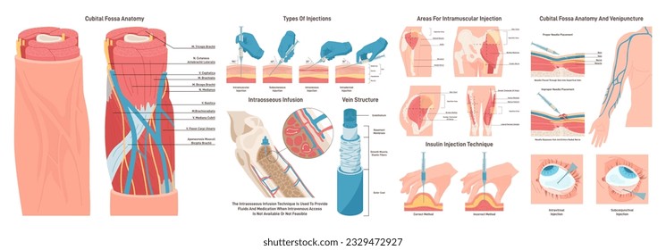 Injection sites set. Medicine injection sites on the human body. Intramuscular and intraosseous injection and venipuncture. Cubital fossa anatomy and vein structure. Flat vector illustration