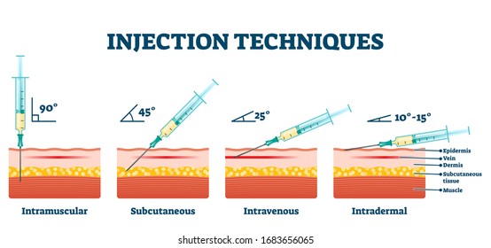 Injection techniques vector illustration. Labeled educational medical procedure examples scheme. Various methods of needle jab in skin. Intramuscular, subcutaneous, intravenous and intradermal process