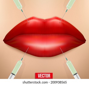 Injection of Treatment with botox or hyaluronic, collagen. Vector illustration.