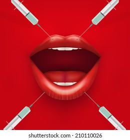 Injection of Treatment. Lips and syringes. Vector illustration.