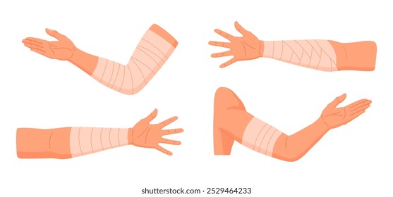 Injured human arms. Bandaged elbows and forearms, damaged arm parts, emergency treatment for bones fractures and sprains flat vector illustration set. Physical injury bandages