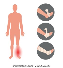 Injured leg ankles with bandage. First aid kit steps