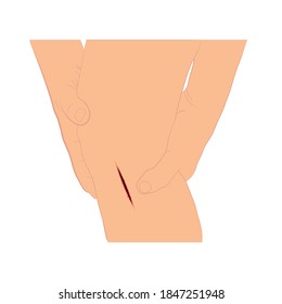 injured leg with bleeding gash with wound on the leg vector illustration