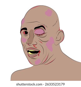 Injured man with many bruises on his face.