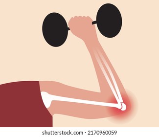 Injury and elbow pain. Flat vector stock illustration with joint disease. Person with inflammation or arthritis, athlete with dumbbells