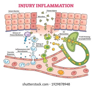 Injury inflammation process as body response to microbes in wound educational outline diagram. Labeled anatomical cross section with tissue trauma and bruise repair explanation vector illustration.