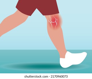 Injury and pain to knee. Flat vector stock illustration with joint disease. Person with inflammation or arthritis of leg