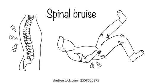 Injury to the soft tissues of the back in the paravertebral region as a result of mechanical impact on the spinal column. The man fell on his back and felt pain in his spine. Vector illustration.