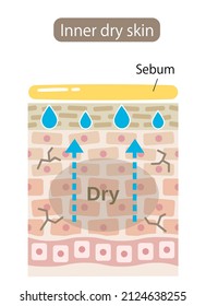 inner dry skin cell layer. skin produce extra sebum to moisturize but below is dehydrated due to water loss. Skin care beauty concept