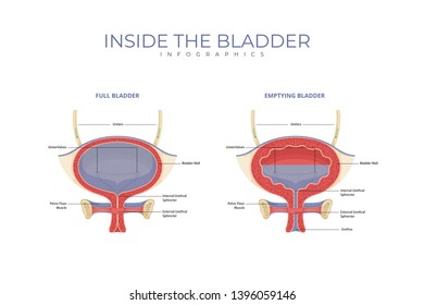 Inside The Bladder Medical Infographic Chart Composition Poster Illustration, Suitable For Education, Presentation, Print and Other Related Occasion