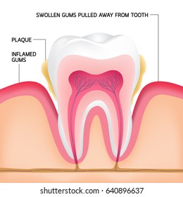 2,057 Anatomical parts the tooth Images, Stock Photos & Vectors ...