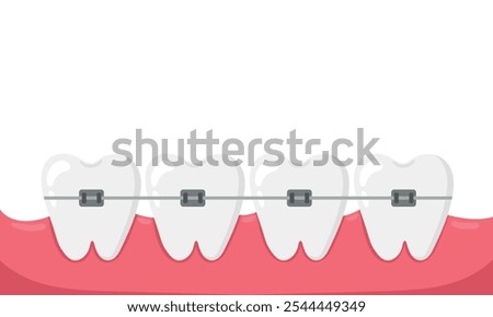 Installation of braces on teeth, straightening of crooked bites. Vector illustration