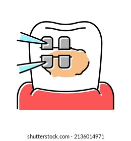 installation tooth braces color icon vector. installation tooth braces sign. isolated symbol illustration