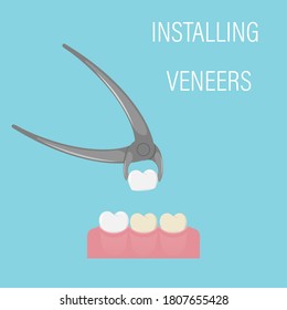 The installation of the veneer. Alternative to bleaching. Cosmetic dental procedure, Aesthetic dentistry, modern medicine. Veneers in forceps. Simple illustration in a flat style. Isolated vector