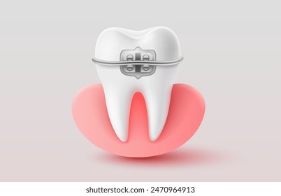 Installing braces on teeth, straightening crooked bites. Vector illustration