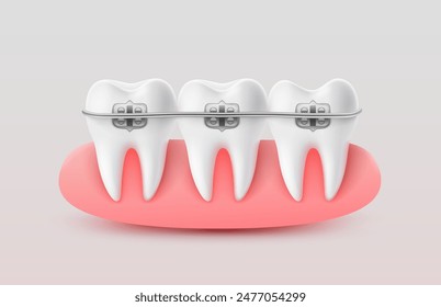 Installing braces on teeth, straightening crooked bites. Vector illustration