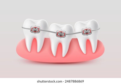 Installing braces on teeth, straightening crooked bites. Vector illustration