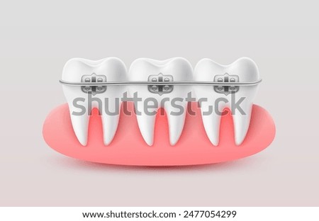 Installing braces on teeth, straightening crooked bites. Vector illustration