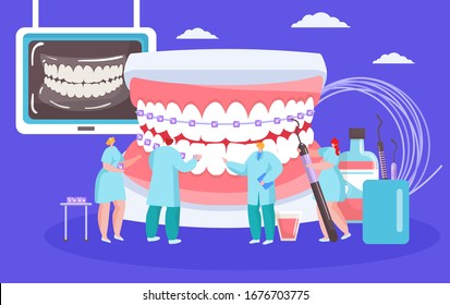 Installing dental braces vector illustration with dentists mini people with huge mouth orthodontic cocept. White spots braces on teeth, stomatology, dentistry, orthodontry healthcare.