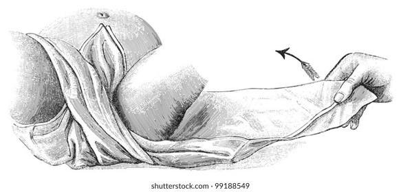 Instructions changing diaper of a baby / vintage illustration from Die Frau als hausarztin 1911