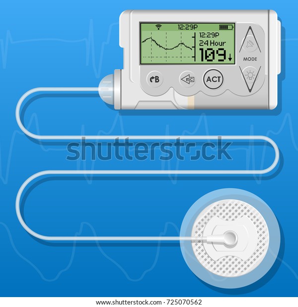 Insulin Infusion Pump On Patient Body Stock Vector (Royalty Free) 725070562