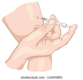 Insulin Injection In A Shoulder. Vector Illustration.