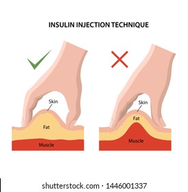 Printable Insulin Injection Site Chart