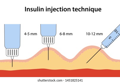 Insulin Injection Technique For Diabetes Depending On Needle Length. Anatomical Vector Illustration In Flat Style Isolated Over White Background.