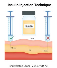 Diagrama de Ilustración vectorial de diseño de Ciencia de técnica de inyección de insulina