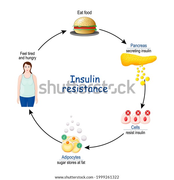 Insulin Resistance Cycle Insulin Glucose Before Stock Vector (Royalty