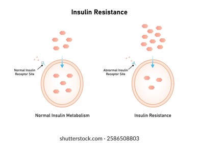 Insulin Resistance Science Design. Vector Illustration.