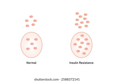 Insulin Resistance Science Design. Vector Illustration.