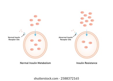 Insulin Resistance Science Design. Vector Illustration.