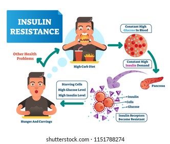 Insulin resistance vector illustration. Labeled scheme with all cycle of process. High glucose in blood, constant demand. Medical diagram how reporters become resistant, hunger, carvings and carb diet
