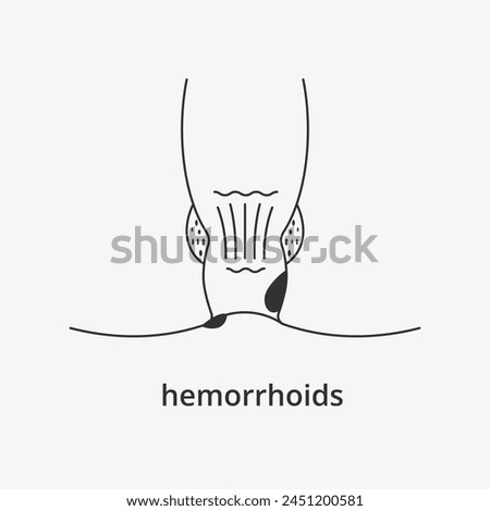 Internal and external hemorrhoids line icon. Infographic anal structure. Vector illustration