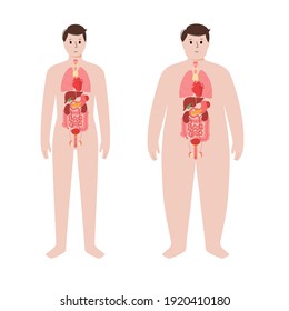 Internal organs in body of a man. Normal and obese male silhouette medical poster. Stomach, heart, kidney. Digestive, respiratory and cardiovascular systems. Human anatomy flat vector illustration