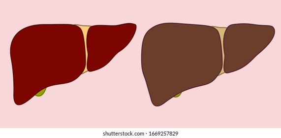 Internal organs, healthy and sick human liver, flat style, vector, liver icon