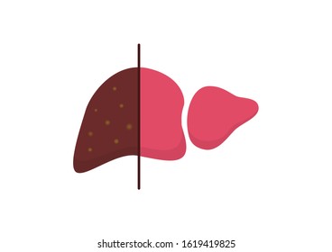 Internal organs of the human on white background, Human liver anatomy, comparison of healthy and sick human liver, Liver icon, Organs symbol, Cartoon vector illustration