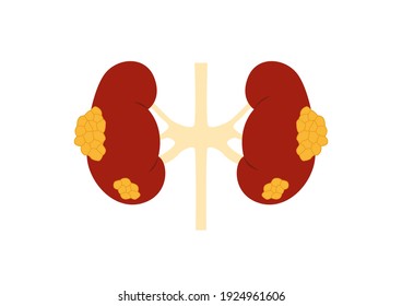 Internal organs of the human on white background, Kidneys cancer, Kidneys anatomy, Kidneys icon, Organs symbol, Cartoon vector illustration.