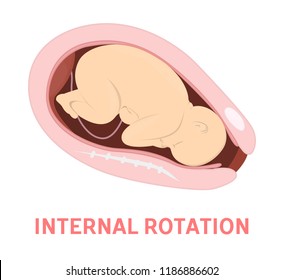 Fetal Movement Images Stock Photos Vectors Shutterstock