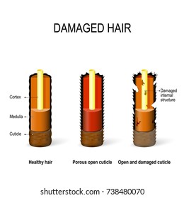 Internal Structure Of The Healthy And Damaged Hair: Cuticle, Cortex, Medulla. Porous, Open And Damaged Cuticle