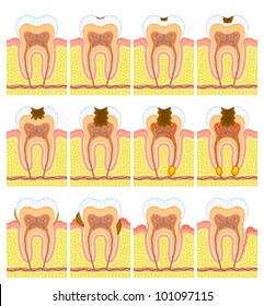 Internal structure of tooth