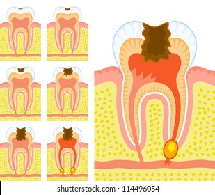 Internal structure of tooth 