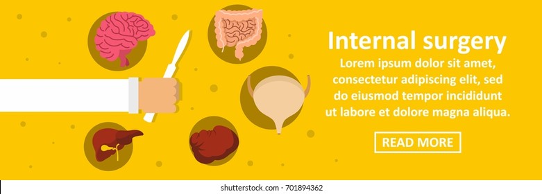 Internal surgery banner horizontal concept. Flat illustration of internal surgery banner horizontal vector concept for web