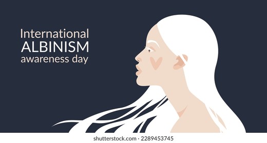 Día Internacional de Concienciación sobre el Albinismo. La cara de una chica albina y el cabello blanco con el corazón en la mejilla. Aspecto natural. Ilustración del vector