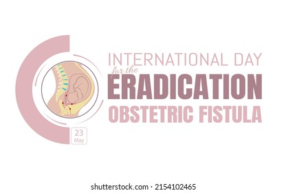 Día Internacional para la erradicación de la fístula obstétrica.diagrama de donde puede formarse la fístula.ilustración vectorial plana