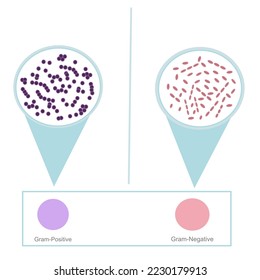 Resultado interpretativo de la técnica de tinción de gramo sobre deslizamiento de vidrio después de tinción con una sustancia química específica (Violeta de cristal, Yodo y Safranina): Bacterias grampositivas y negativas